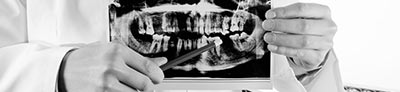 Dentist holding an x-ray image.